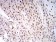 LGALS1 Primary Antibody MP31021 [M1H11C5]