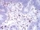 CD2 Primary Antibody MP31026 [M3D1E3]
