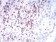 CD2 Primary Antibody MP31026 [M3D1E3]