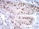 PSMC3 Primary Antibody MP31040 [M1G10B7]