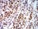 DDX1 Primary Antibody MP31066 [M3E5E2]