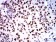 ZFP91 Primary Antibody MP31085 [M8C3D5]
