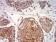 CPV-NS1 Primary Antibody MP31093 [M2B5B7]