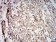 SOD2 Primary Antibody MP31095 [M8H3F9]