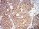 SOD2 Primary Antibody MP31095 [M8H3F9]