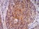 RALB Primary Antibody MP31120 [M7F8B4]