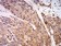 P2RX7 Primary Antibody MP31128 [M7G1D6]