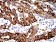 KRT19 Primary Antibody MP31131 [M8H1A8]