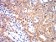 KRT10 Primary Antibody MP31133 [M3C2F5]