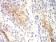 KRT10 Primary Antibody MP31134 [M1C3D9]