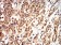 CCND1 Primary Antibody MP31137 [M3B6G3]