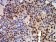 CIRBP Primary Antibody MP31147 [M6E12B3]