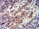 Phospho-4E-BP1 (Ser65) Primary Antibody MP31174 [M1E2E7]