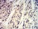 Phospho-4E-BP1 (Ser65) Primary Antibody MP31174 [M1E2E7]