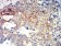 PRKAA2 Primary Antibody MP31179 [M5B4G1]