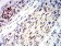 TFAP2C Primary Antibody MP31193 [M3A11A5]
