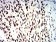 SMARCA1 Primary Antibody MP31205 [M2H7B9]