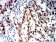SMARCA1 Primary Antibody MP31205 [M2H7B9]