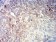 BCL2L10 Primary Antibody MP31213 [M8A2F9]