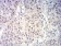 BCL11B Primary Antibody MP31219 [M1F8G8]