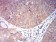 CHRNA6 Primary Antibody MP31226 [M5B6G8]