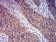 GRM3 Primary Antibody MP31256 [M7A5A6]