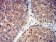 GRM5 Primary Antibody MP31259 [M1A11D10]