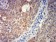 GRM5 Primary Antibody MP31259 [M1A11D10]