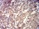 GRIK4 Primary Antibody MP31266 [M8H5H9]