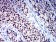 BCL9L Primary Antibody MP31298  [M3B9C1]