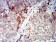 TNFSF11 Primary Antibody MP31305 [M3H8A7]