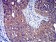 P2RY8 Primary Antibody MP31307 [M1G5A11]