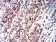 P2RY1 Primary Antibody MP31320 [M4G5D6]