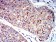 P2RY1 Primary Antibody MP31321  [M4G5B7]