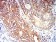 CD195 Primary Antibody  MP31326 [M6G11D1]