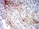 CD183 Primary Antibody MP31359 [M5C10B3]