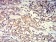 ACTR3 Primary Antibody MP31386 [M3G2G1]