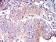 CD102 Primary Antibody MP31390 [M7A6E11]