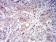 CD63 Primary Antibody MP31423 [M1E8D4]