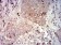 CD66A Primary Antibody MP31433 [M7B9G3]