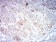 CD66A Primary Antibody MP31433 [M7B9G3]