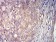 CD156 Primary Antibody  MP31602  [M2C1F3]