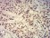 EHMT2 Primary Antibody MP31627  [M2D12A11]