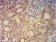 KAT2B Primary Antibody MP31630  [M7D12C8]