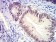 SATB2 Primary Antibody  MP31641 [M7B2E11]
