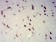 RBFOX2 Primary Antibody MP31645  [M1E7G10]