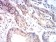 KAT7 Primary Antibody MP31672  [M1D9H9]