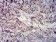 PCK2 Primary Antibody  MP31700  [M3D3E11]