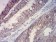 PCK2 Primary Antibody  MP31700  [M3D3E11]