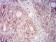 CD315 Primary Antibody MP31708  [M4E9G7]